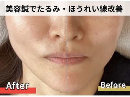 ナチュラルエイジングプラス(naturalaging+)の写真