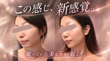 ゲリール(Guerir)