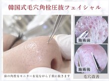 モミン(MOMI.N)