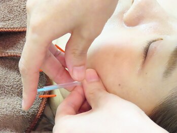 ばば鍼灸院/ほとんど痛みも感じません