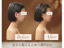 ミピアーチェ(Mi piace.)の雰囲気（首・頭蓋骨から整え、立体小顔＆引き締まったフェイスラインへ）