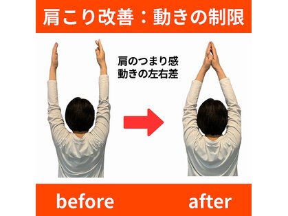 ララ鍼灸サロン(LaLa鍼灸サロン)の写真