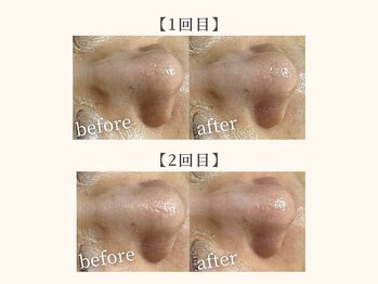 ドリームスパ 町田店(DREAM SPA)/before→after