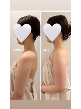 ソレイユ麻布鍼灸整体院/猫背・巻き型改善コース