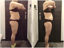 美容整体ウェリナ 名駅院/小顔矯正/骨盤矯正/美脚サロン