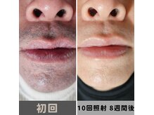 キムラケ 和光別邸(木村家 KIMURAKE)の雰囲気（激変☆1回あたりの抜ける毛量が多いので最小回数&金額的におトク）