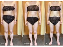 アンドワイ バイ サロンリーナ(&y by Salon Lena)/【深層汗腺リンパマッサージ】