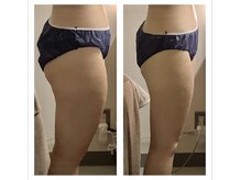 アクア エステティコ 亀有(ACQUA estetico)の雰囲気(キャビテーションやラジオ波で固いセル脂肪にも◎)