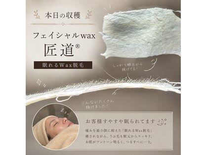 エピリア(Epilear)の写真