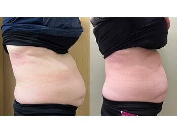 ココア(CoCoa)/トレーニング×最新マシン