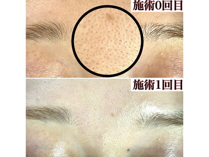 エクレ 下北沢店(ecle)の写真