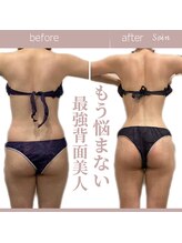 ソワン(Soin)/20代　背面