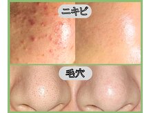 スリー ときわ台(Three)