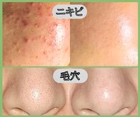 スリー ときわ台(Three)