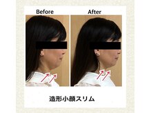 ラディアントミューズ(RadiantMuse)の雰囲気（造形小顔スリムでキュッと小顔。）