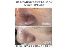 メープルサロン(MAPLE SALON)の雰囲気(毛穴以外のお悩みにも!つや肌エイジングコースで集中ケア)