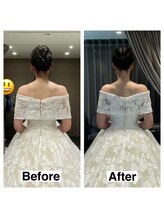 ライズ/お客様のビフォーアフター