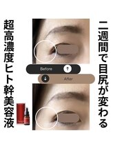 ララスマイル 鶴崎森町店/お肌改善プログラム(しわケア)