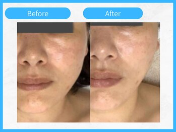 トウメイコガオ 横浜店/トウメイコガオでハーブ