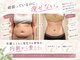 ヨサパーク ハーブ ラキ 鳴海店(YOSA PARK herb *Laki)の写真