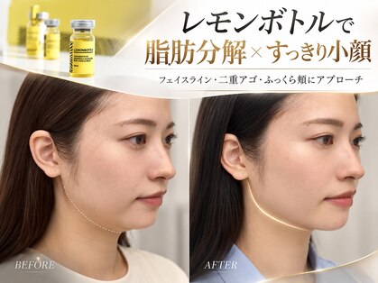 美助(bisuke)の写真