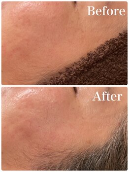 シュシュ 立川駅前(ChouChou)/1度でこんなに!!