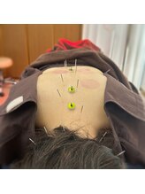 シンシンラボ 豪徳寺(SHINSHIN Lab)/自律神経調整は鍼灸の得意分野！