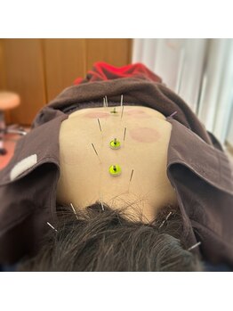 シンシンラボ 豪徳寺(SHINSHIN Lab)/自律神経調整は鍼灸の得意分野!
