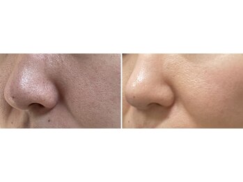 エスケア(S-CARE)/ホームケアとの併用がオススメ＊