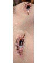 コア(Koa)/パリジェンヌアップリフト