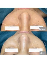 ちらちゅら/イラストリアス