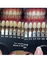 トウキョースワーズ 渋谷店(TOKYO SWRS)/#ホワイトニング #渋谷 #池袋