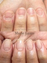 マリーロール 淀屋橋本店(Marie Laure)/自爪育成/深爪矯正/ネイルケア
