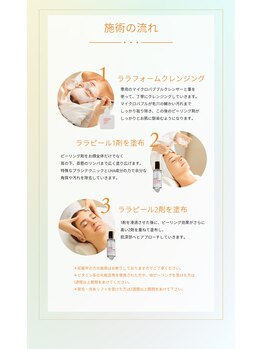 トゥインクル(Twinkle)/ララピール施術の流れ