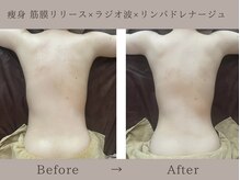 ミアヴェール(Miaveil)の雰囲気（季節問わず人気の痩身！都度払い・回数券ご用意しております◎）