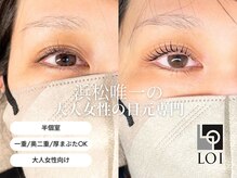 ロイ 初生店(LOI)