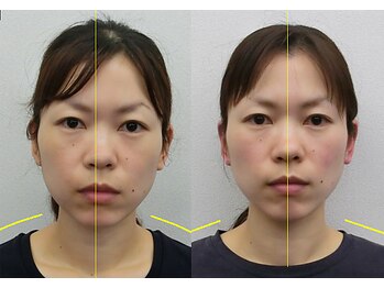 宮崎整体院/【美容整体】全身根本改善コース