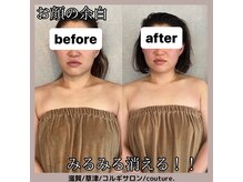 クチュール(couture.)/小顔コルギ