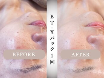 モルティー 小山店(Molti)の写真/【肌質改善・肌育専門サロン】その場で効果実感!肌質改善パックとオールハンド手技でツヤぷるお肌に◎小山