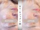 モルティー 小山店(Molti)の写真/【肌質改善・肌育専門サロン】その場で効果実感!肌質改善パックとオールハンド手技でツヤぷるお肌に◎小山