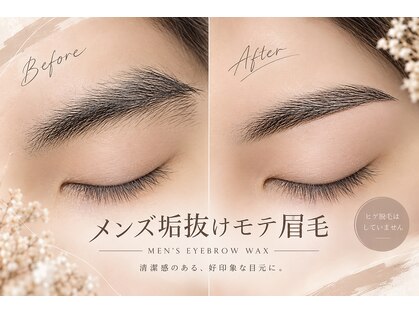 ビバ(Viva)の写真