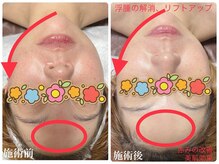 トータルビューティーサロン デザイン/光フェイシャル都度払い