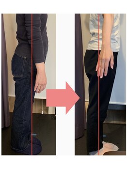 リベスト(RE:BEST)/【全身矯正】ポッコリお腹改善