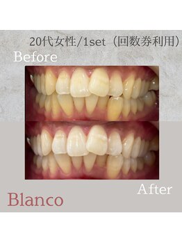 ブランコ 川口店(Blanco)/回数券ご利用♪お客様お写真