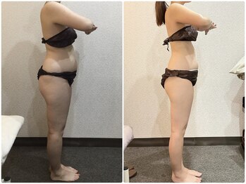 美容整体ウェリナ 名駅院/小顔矯正/骨盤矯正/美脚サロン