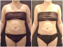 美容整体 ウェリナ 蟹江院/小顔矯正/骨盤矯正/美脚サロン