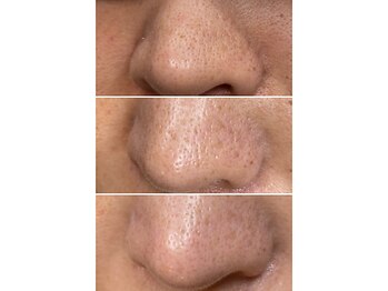 サイ(Sai)/before⇒after