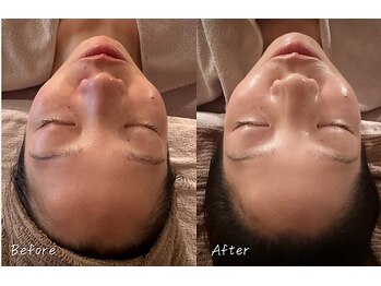 エステサロン マコ(MaCo)/30代・たるみ改善/小顔ケア