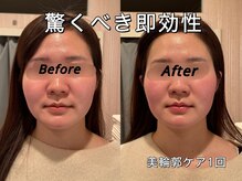 薬手名家 心斎橋店/お客様ビフォーアフター