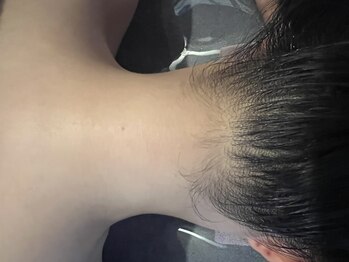 セッテベーレ(Sette Belle)の写真/【プロの技術とこだわりマシン】これからの季節に向けて、自信をもって魅せる、隙のない素肌へ！
